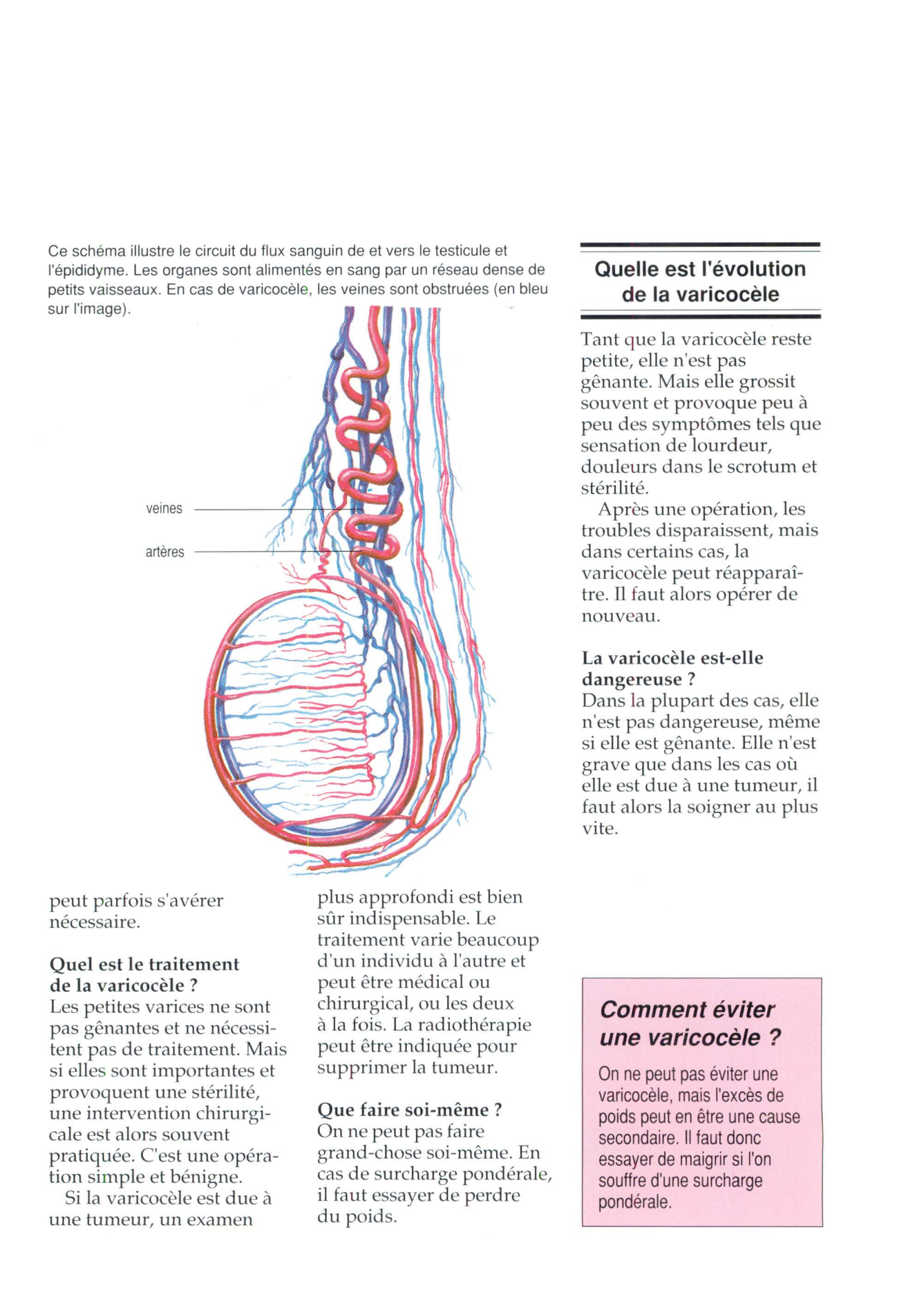 Prévisualisation du document Varicocèle